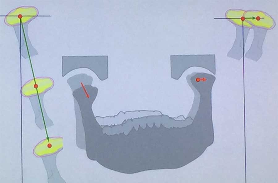 Orthodontie bij kinderen en jongvolwassenen