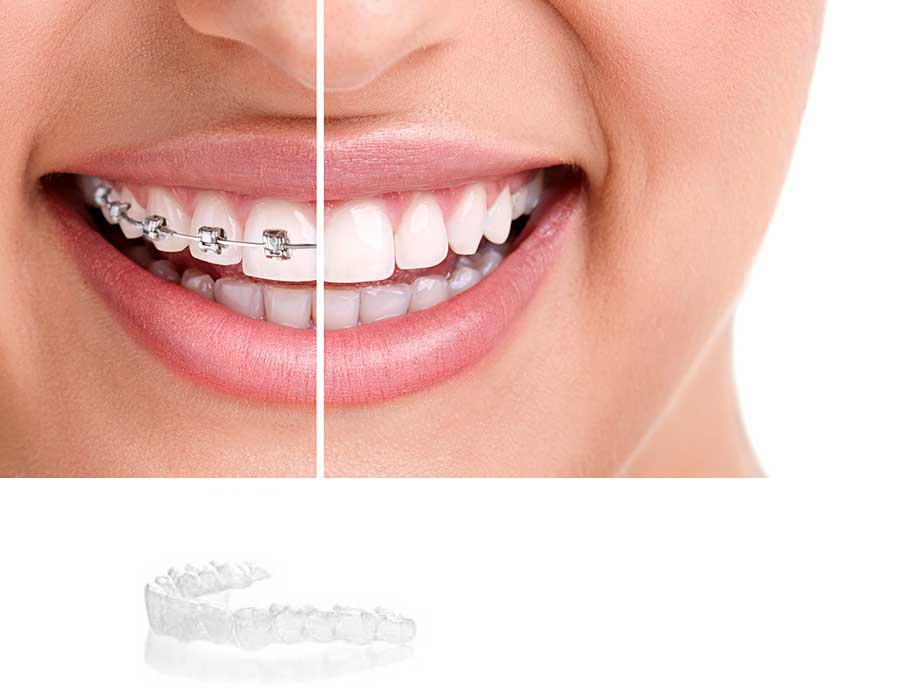 orthodontist Turnhout De Zutter