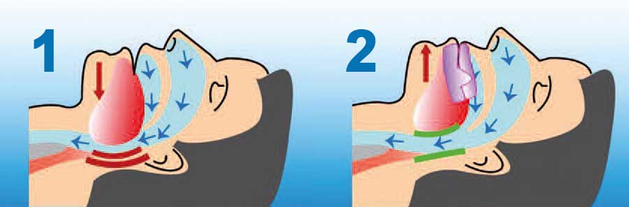 orthodontist Turnhout De Zutter